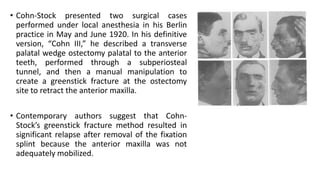• Cohn-Stock presented two surgical cases
performed under local anesthesia in his Berlin
practice in May and June 1920. In his definitive
version, “Cohn III,” he described a transverse
palatal wedge ostectomy palatal to the anterior
teeth, performed through a subperiosteal
tunnel, and then a manual manipulation to
create a greenstick fracture at the ostectomy
site to retract the anterior maxilla.
• Contemporary authors suggest that Cohn-
Stock’s greenstick fracture method resulted in
significant relapse after removal of the fixation
splint because the anterior maxilla was not
adequately mobilized.
 