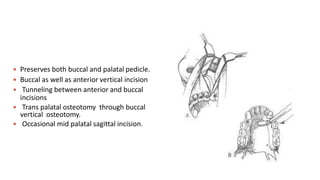  Preserves both buccal and palatal pedicle.
 Buccal as well as anterior vertical incision
 Tunneling between anterior and buccal
incisions
 Trans palatal osteotomy through buccal
vertical osteotomy.
 Occasional mid palatal sagittal incision.
 