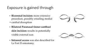Exposure is gained through
 Bicoronal incision: more extensive
procedure, possibly entailing medial
• canthal disruption
 Bilateral Paranasal (inner canthus)
skin incision: results in potentially
visible external scar.
 Intraoral access was also described for
Le Fort II osteotomy.
 