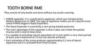 TOOTH BORNE RME
They consist of only bands and wires without any acrylic covering.
• HYRAX expander: It is a tooth borne appliance, which was introduced by
William Biederman in 1968. This type of appliance makes use of a special screw
called HYRAX (Hygenic Rapid Expander).
• The Hyrax Expander is essentially a non-spring loaded jackscrew
• The main advantage of this expander is that it does not irritate the palatal
mucosa and is easy to keep clean.
• It is capable of providing sutural separation of 11 mm within a very short period
of wear and a maximum of 13 mm can also be achieved.
• Each activation of the screw produces approximately 0.2 mm of lateral
expansion and it is activated from front to back.
 