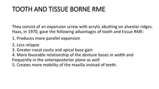 TOOTH AND TISSUE BORNE RME
They consist of an expansion screw with acrylic abutting on alveolar ridges.
Haas, in 1970, gave the following advantages of tooth and tissue RME:
1. Produces more parallel expansion
2. Less relapse
3. Greater nasal cavity and apical base gain
4. More favorable relationship of the denture bases in width and
frequently in the anteroposterior plane as well
5. Creates more mobility of the maxilla instead of teeth.
 