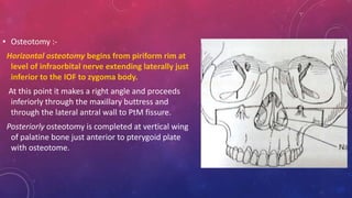 Maxillary osteotomy | PPTX