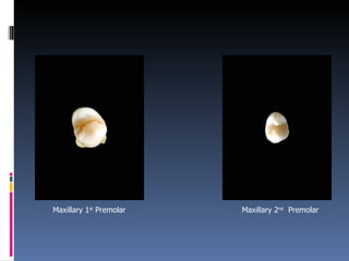 Maxillary 1 st  Premolar Maxillary 2 nd   Premolar 
