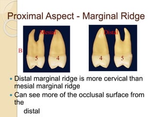 Marginal Ridges Leveling PERMANENT MAXILLARY PREMOLARS | PPTX