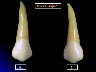 4 5
Buccal aspect.
 