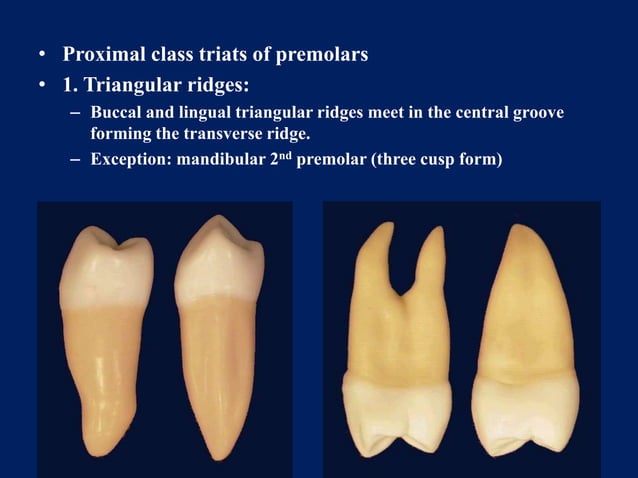 class traits of premolars and Maxillary 1st premolar.pptx