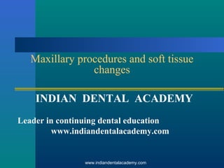 Maxillary procedures and soft tissue
changes
INDIAN DENTAL ACADEMY
Leader in continuing dental education
www.indiandentalacademy.com

www.indiandentalacademy.com

 