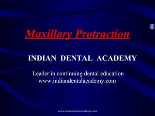 Maxillary Protraction
INDIAN DENTAL ACADEMY
Leader in continuing dental education
www.indiandentalacademy.com

www.indiandentalacademy.com

 