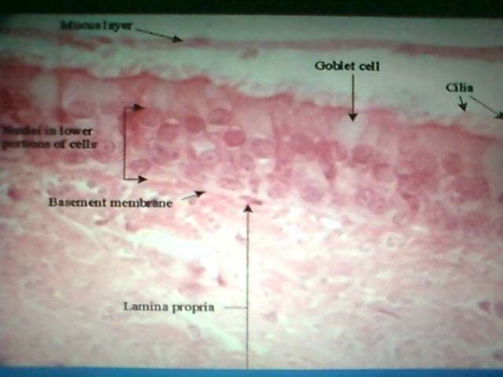 Maxillary Sinus diagram of nasal cavity 