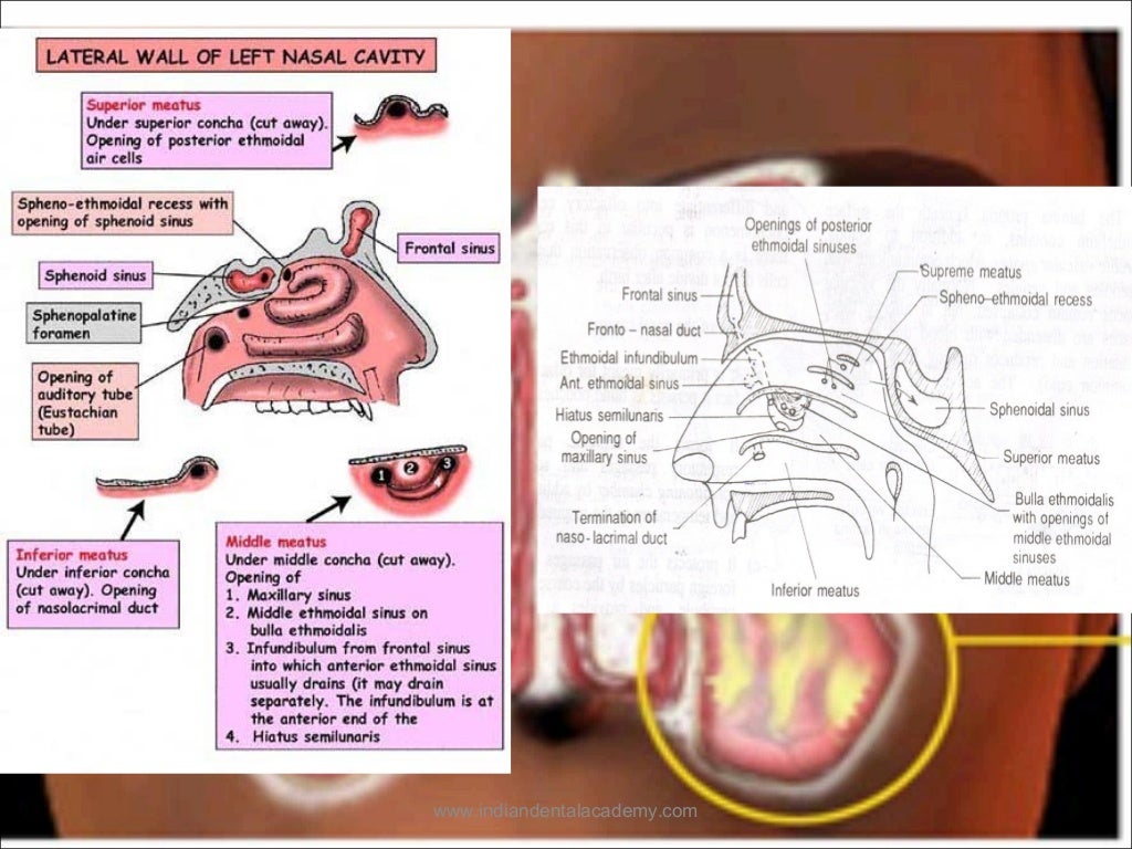 Maxillary sinus /certified fixed orthodontic courses by Indian dental…