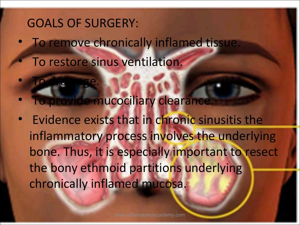 Maxillary sinus /certified fixed orthodontic courses by Indian dental…