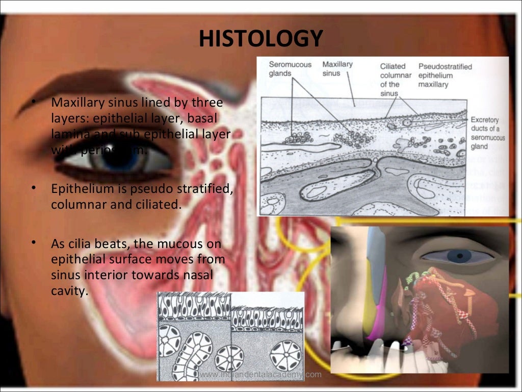 Maxillary sinus /certified fixed orthodontic courses by Indian dental…