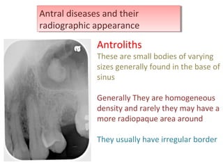 radiology of Maxillary sinus | PPT