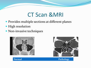 CT Scan &MRI
 Provides multiple sections at different planes
 High resolution
 Non-invasive techniques
Normal Pathology
 
