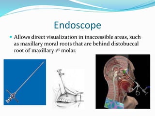 Endoscope
 Allows direct visualization in inaccessible areas, such
as maxillary moral roots that are behind distobuccal
root of maxillary 1st molar.
 