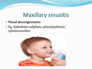 Maxillary sinusitis
 Nasal decongestants:
 Eg. Ephedrine sulphate, phenylephirine,
xylometazoline.
 