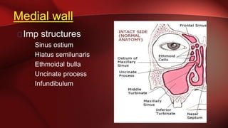 Medial wall
Imp structures
Sinus ostium
Hiatus semilunaris
Ethmoidal bulla
Uncinate process
Infundibulum
 
