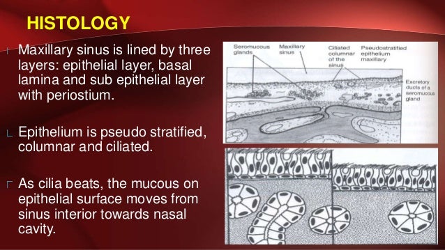 Maxillary sinus