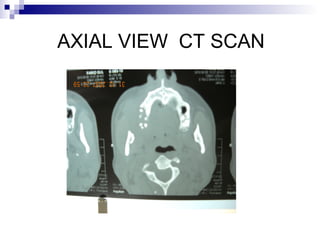 AXIAL VIEW CT SCAN
 