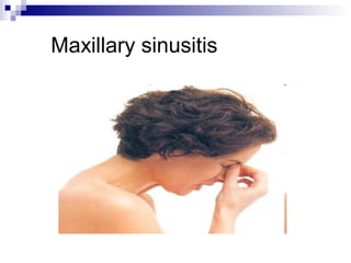 Maxillary sinusitis
 