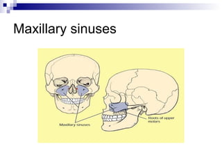 Maxillary sinuses
 