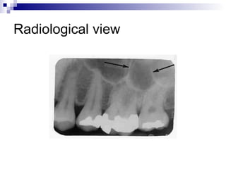 Radiological view
 