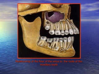 Relationship of the floor of the sinus to the roots of theRelationship of the floor of the sinus to the roots of the
maxillary teethmaxillary teeth
 