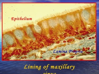 Lining of maxillary
Epithelium
Lamina Propria
 