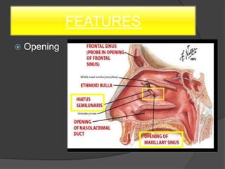 FEATURES
 Opening
 