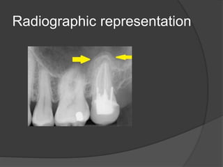 Radiographic representation
 