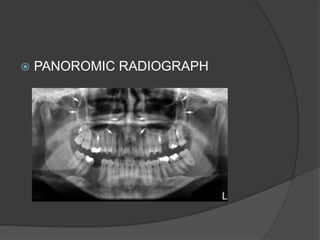  PANOROMIC RADIOGRAPH
 