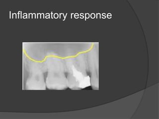 Inflammatory response
 