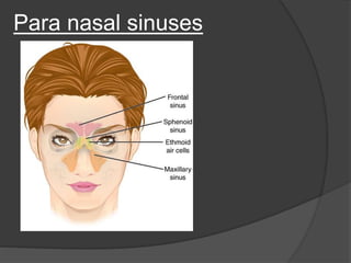 Para nasal sinuses
 