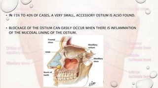 • IN 15% TO 40% OF CASES, A VERY SMALL, ACCESSORY OSTIUM IS ALSO FOUND.
• BLOCKAGE OF THE OSTIUM CAN EASILY OCCUR WHEN THERE IS INFLAMMATION
OF THE MUCOSAL LINING OF THE OSTIUM.
 