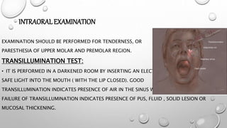 INTRAORALEXAMINATION
EXAMINATION SHOULD BE PERFORMED FOR TENDERNESS, OR
PARESTHESIA OF UPPER MOLAR AND PREMOLAR REGION.
TRANSILLUMINATION TEST:
• IT IS PERFORMED IN A DARKENED ROOM BY INSERTING AN ELECTRICALLY
SAFE LIGHT INTO THE MOUTH ( WITH THE LIP CLOSED). GOOD
TRANSILLUMINATION INDICATES PRESENCE OF AIR IN THE SINUS WHILE THE
FAILURE OF TRANSILLUMINATION INDICATES PRESENCE OF PUS, FLUID , SOLID LESION OR
MUCOSAL THICKENING.
 