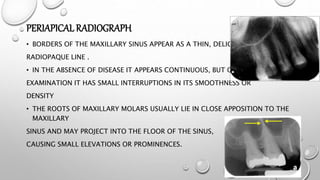 PERIAPICAL RADIOGRAPH
• BORDERS OF THE MAXILLARY SINUS APPEAR AS A THIN, DELICATE
RADIOPAQUE LINE .
• IN THE ABSENCE OF DISEASE IT APPEARS CONTINUOUS, BUT ON CLOSE
EXAMINATION IT HAS SMALL INTERRUPTIONS IN ITS SMOOTHNESS OR
DENSITY
• THE ROOTS OF MAXILLARY MOLARS USUALLY LIE IN CLOSE APPOSITION TO THE
MAXILLARY
SINUS AND MAY PROJECT INTO THE FLOOR OF THE SINUS,
CAUSING SMALL ELEVATIONS OR PROMINENCES.
 
