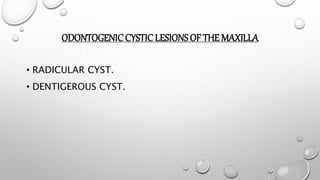 ODONTOGENICCYSTICLESIONS OF THE MAXILLA
• RADICULAR CYST.
• DENTIGEROUS CYST.
 