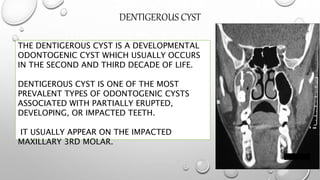 DENTIGEROUS CYST
THE DENTIGEROUS CYST IS A DEVELOPMENTAL
ODONTOGENIC CYST WHICH USUALLY OCCURS
IN THE SECOND AND THIRD DECADE OF LIFE.
DENTIGEROUS CYST IS ONE OF THE MOST
PREVALENT TYPES OF ODONTOGENIC CYSTS
ASSOCIATED WITH PARTIALLY ERUPTED,
DEVELOPING, OR IMPACTED TEETH.
IT USUALLY APPEAR ON THE IMPACTED
MAXILLARY 3RD MOLAR.
 