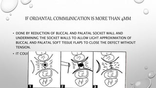 IF OROANTAL COMMUNICATION IS MORE THAN 4MM
• DONE BY REDUCTION OF BUCCAL AND PALATAL SOCKET WALL AND
UNDERMINING THE SOCKET WALLS TO ALLOW LIGHT APPROXIMATION OF
BUCCAL AND PALATAL SOFT TISSUE FLAPS TO CLOSE THE DEFECT WITHOUT
TENSION.
• IT COULD BE SUPPORTED BY SMALL PALATAL RELAXING INCISIONS.
 