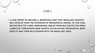 CASE 2
• A CASE REPORT BY MICHAEL A. BRUNSVOLD SAID THAT MAXILLARY SINUSITIS
MAY DEVELOP FROM THE EXTENSION OF PERIODONTAL DISEASE. IN THIS CASE,
RECONSTRUCTED THREE-DIMENSIONAL IMAGES FROM MULTIDETECTOR SPIRAL
COMPUTED TOMOGRAPHS WERE HELPFUL IN EVALUATING PERIODONTAL BONY
DEFECTS AND THEIR RELATIONSHIP WITH THE MAXILLARY SINUS.
 
