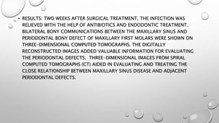• RESULTS: TWO WEEKS AFTER SURGICAL TREATMENT, THE INFECTION WAS
RELIEVED WITH THE HELP OF ANTIBIOTICS AND ENDODONTIC TREATMENT.
BILATERAL BONY COMMUNICATIONS BETWEEN THE MAXILLARY SINUS AND
PERIODONTAL BONY DEFECT OF MAXILLARY FIRST MOLARS WERE SHOWN ON
THREE-DIMENSIONAL COMPUTED TOMOGRAPHS. THE DIGITALLY
RECONSTRUCTED IMAGES ADDED VALUABLE INFORMATION FOR EVALUATING
THE PERIODONTAL DEFECTS. THREE-DIMENSIONAL IMAGES FROM SPIRAL
COMPUTED TOMOGRAPHS (CT) AIDED IN EVALUATING AND TREATING THE
CLOSE RELATIONSHIP BETWEEN MAXILLARY SINUS DISEASE AND ADJACENT
PERIODONTAL DEFECTS.
 