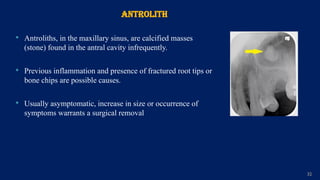 Maxillary Sinus.pptx 1st bds lecture histology | PPTX