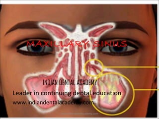MAXILLARY SINUS

INDIAN DENTAL ACADEMY
Leader in continuing dental education
www.indiandentalacademy.com
www.indiandentalacademy.com

 