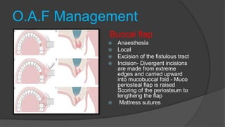 O.A.F Management
Buccal flap
 Anaesthesia
 Local
 Excision of the fistulous tract
 Incision- Divergent incisions
are made from extreme
edges and carried upward
into mucobuccal fold - Muco
periosteal flap is raised
Scoring of the periosteum to
lengtheng the flap
 Mattress sutures
 