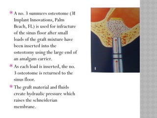 MAXILLARY SINUS ELEVATION floor for implant | PPTX