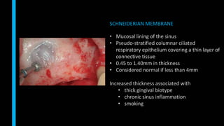 • Mucosal lining of the sinus
• Pseudo-stratified columnar ciliated
respiratory epithelium covering a thin layer of
connective tissue
• 0.45 to 1.40mm in thickness
• Considered normal if less than 4mm
Increased thickness associated with
• thick gingival biotype
• chronic sinus inflammation
• smoking
SCHNEIDERIAN MEMBRANE
 
