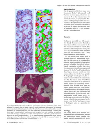 Maxillary sinus floor elevation with bovine bone mineral combined with ...