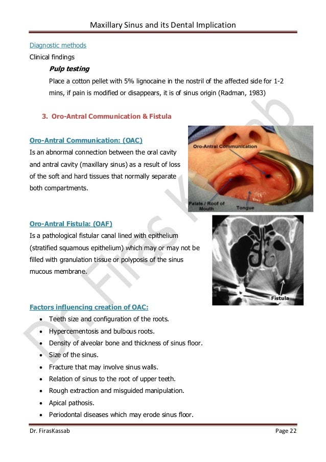 Maxillary sinus & its dental implication