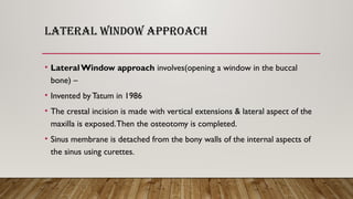 Comprehensive Guide to Maxillary Sinus Lift Procedures for Dental ...