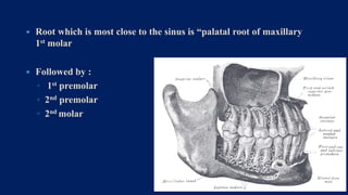  Root which is most close to the sinus is “palatal root of maxillary
1st molar
 Followed by :
◦ 1st premolar
◦ 2nd premolar
◦ 2nd molar
32
 